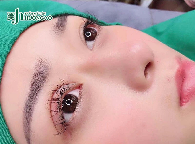 Top 6 địa chỉ cắt mí tại Vinh uy tín: Bác sĩ giỏi, an toàn nhất  